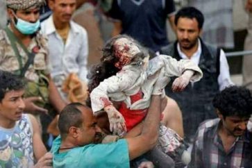 Une fillette yéménite tuée par des bombardements saoudiens contre le Yémen (Archives)