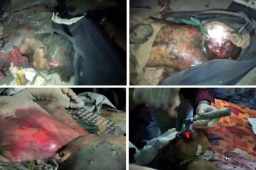 Yémen: un nouveau massacre saoudien à Khokha