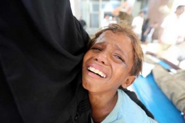 yemen-souffrance