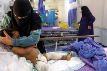 2,2 millions d’enfants au Yémen souffrent de malnutrition aiguë, selon l'Unicef.