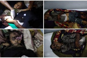 Des victimes du bombardement des mercenaires de la coaliton saoudienne contre Taez, le 24 aout 2023.