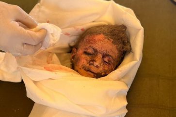 Un bébé martyr des 9 martyrs de la famille Hachach tués dans un raid israélien sur leur maison au nord-ouest de Rafah