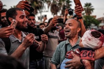 Un enfant gazaoui blessé par les bombardements israéliens contre Gaza